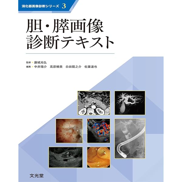 順天堂・東大・がん研流 ERCP・EUSマスターブック: 胆・膵診療の基礎